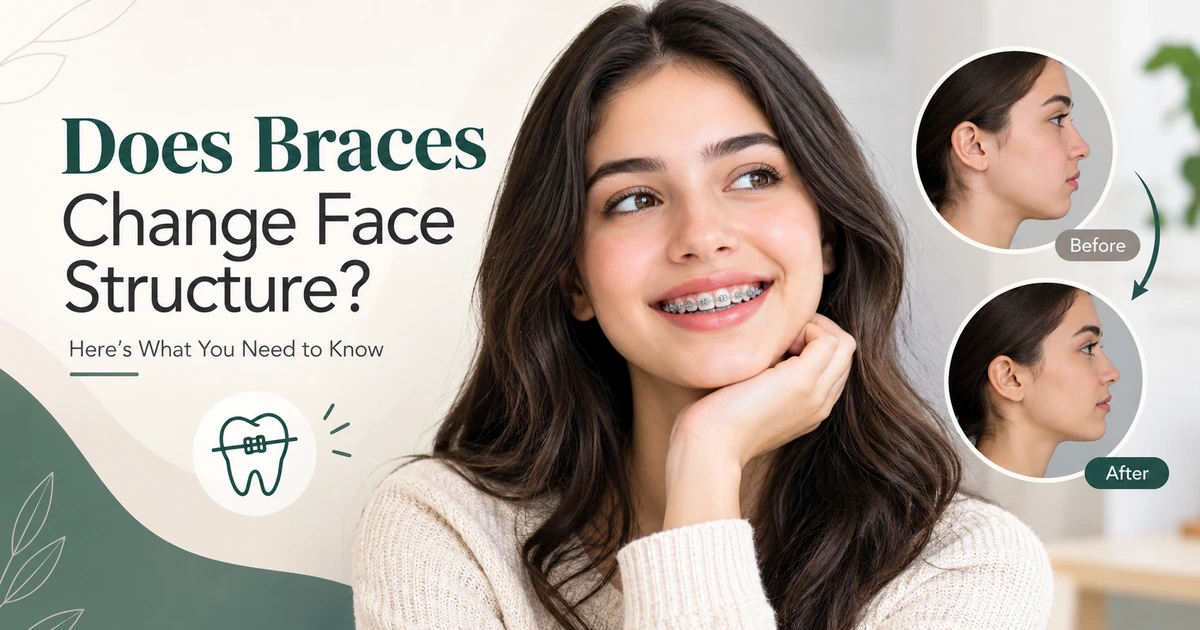 Does Braces Change Face Structure or Only Your Smile